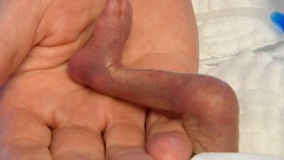 Symbolbild: Holger Hollemann
Risikoschwangere und extrem Frühgeborene aus der Region werden vorrangig im Klinikum Amberg versorgt.