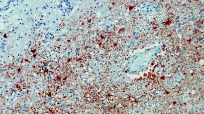 Bild: Bernhard-Nocht-Institut für Tropenmedizin/dpa
Die undatierte Aufnahme zeigt einen Anitkörpernachweis zum Borna-Virus im Gewebe.