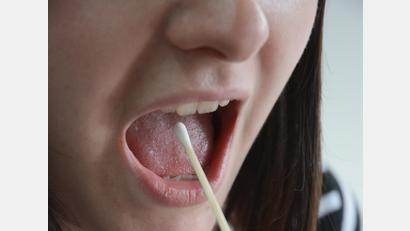 Archivbild: Gabi Schönberger
Mit einem Wangenabstrich kann man sich für die Knochenmarkspender-Datei registrieren lassen.