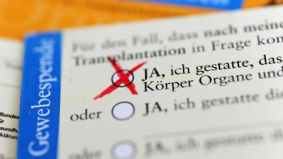 Bild: Marie Reichenbach/dpa
Die Rückseite eines ausgefüllten Organspendeausweises. Das Zustimmungsfeld ist angekreuzt.