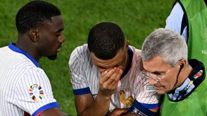 Bild: Fabian Strauch/dpa
Mbappé (M) musste mit stark blutender Nase ausgewechselt werden.