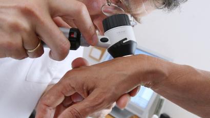 Symbolbild: Karl-Josef Hildenbrand/dpa
Die Zahl der Hauterkrankungen bis hin zum Hautkrebs nimmt zu. Die Zahl der Dermatologen, die sich auf offene Facharztstellen bewirbt, ist jedoch überschaubar. Auch im Landkreis Tirschenreuth sind 1,5 Kassensitze offen.