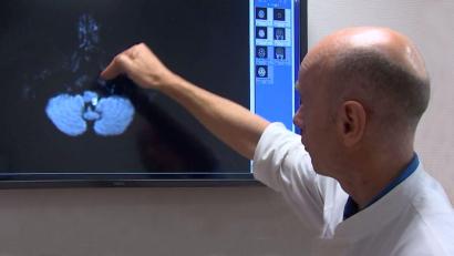 Bild: Klinikum/Dietl/exb
Chefarzt Dr. Frank Huber vom Klinikum St. Marien in Amberg sieht sich das Bild eines Schlaganfalls an.