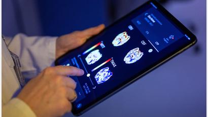 Bild: Monika Skolimowska/dpa
Gehirnbilder eines Patienten in einer KI-basierten App. Nach einer Deloitte-Umfrage sehen viele Bürgerinnen und Bürger den Einsatz von KI in der Medizin skeptisch, vor allem wenn es um die Therapie geht. (Symbolbild)