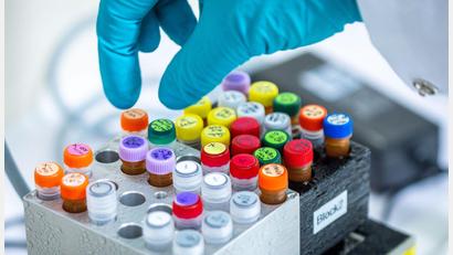 Bild: Jens Büttner/dpa
Ehec bezeichnet bestimmte krankmachende Stämme des Darm-Bakteriums, die vor allem bei Wiederkäuern wie Rindern vorkommen (Archivbild).