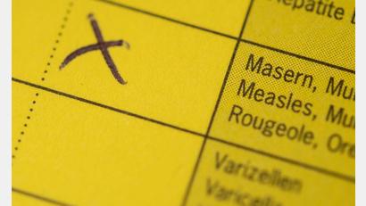 Bild: Marius Becker/dpa
In einem Schnellrestaurant im Landkreis Erding gibt es einen Masernfall (Archivbild)