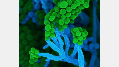 Bild: Ulrich Kück/ Birgit Hoff/Vereinigung für Allgemeine und Angewandte Mikrobiologie/dpa
Penicillium bedeutet auf Lateinisch „kleiner Pinsel“, weil die Zellketten mit Sporen am Ende so ähnlich aussehen (Handout)