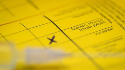 Bild: Friso Gentsch/dpa
Bei Masern zeigt sich erst oft Fieber, bevor später ein Hautausschlag dazukommt. (Symbolbild)