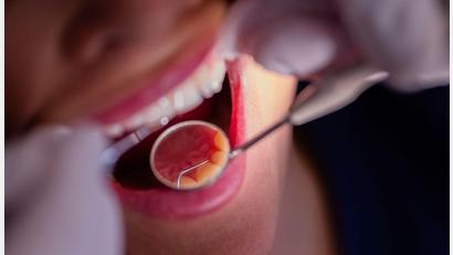 Bild: Rolf Vennenbernd/dpa
Zahnarztbehandlungen sollen nach dem Willen des CDU-Wirtschaftsrats „nicht länger im Umlageverfahren den Beitragszahlern zur Last fallen“. (Symbolbild)