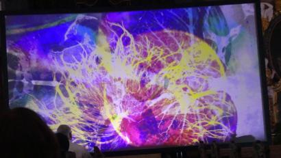 Bild: rn
Ungewöhnliches Konzert im Kloster Speinshart: Zu einem Fest der Farben wurde die visualisierte Tätigkeit der Zellen, die die beiden Hirnhälften verbinden.