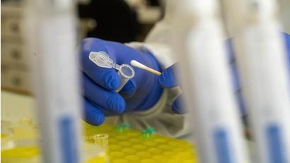 Symbolbild: Stefan Sauer/dpa
Expertinnen und Experten des Leibniz-Institutes untersuchten die menschlichen Knochen, die in einem Straßengraben bei Fronberg gefunden wurden.