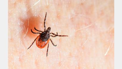 Archivbild: Patrick Pleul/dpa
Der Gemeine Holzbock ist die häufigste Zeckenart in Deutschland und auch die, die hauptsächlich FSME und Borreliose auf den Menschen übertragt.