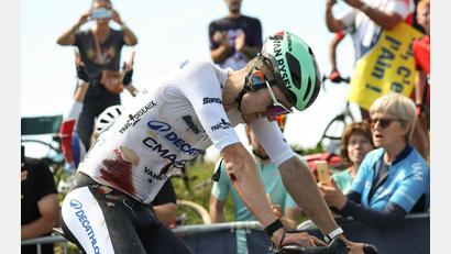 Bild: Anne-Christine Poujoulat/AFP/dpa
Paul Seixas kämpfte sich mit Blut und Löchern auf dem Trikot zurück ans Feld.