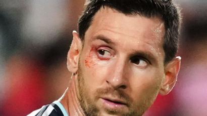 Bild: Ed Zurga/AP/dpa
Wieder gezeichnet: Superstar Lionel Messi.