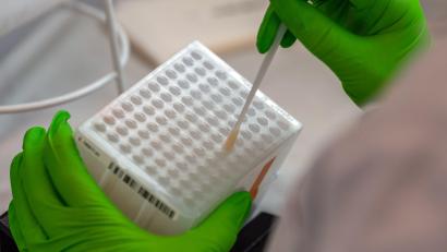 Archivbild: Robert Michael/dpa
Für den Typisierungsprozess der DNA werden Zellen der Wangenschleimhaut entnommen. Hier werden die medizinischen Wattestäbchen für weitere Analysen einsortiert.