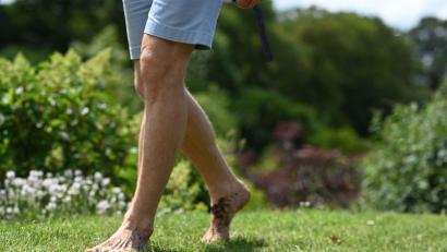 Bild: Lars Penning/dpa
Wer im Sommer barfuß über eine Wiese geht, könnte später einen Juckreiz am Körper spüren. (Symbolbild)