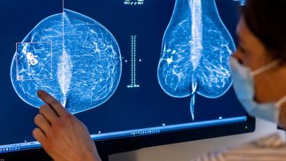 Bild: Hannibal Hanschke/dpa
Nach Angaben der Charité leben rund 68.000 Frauen in Deutschland mit Brustkrebs, der Metastasen gebildet hat (Archivbild).