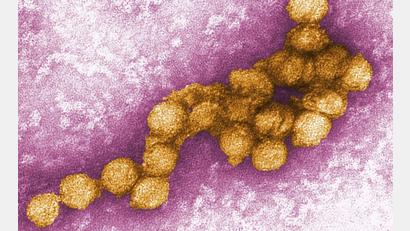 Bild: Cynthia Goldsmith/CENTERS FOR DISEASE CONTROL/EPA/dpa
Die Weltgesundheitsorganisation (WHO) hatte erst kürzlich wegen mehrerer Erkrankungen an West-Nil-Fieber in Südeuropa zu verstärkter Wachsamkeit aufgerufen.