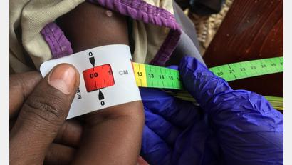 Bild: Eva-Maria Krafczyk/dpa
Schon jetzt gelten fast zwei Millionen Kinder in Somalia akut unterernährt. (Archivbild)