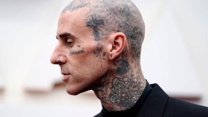 Bild: Jae C. Hong/Invision/AP/dpa
Travis Barker geht davon aus, dass er in ein paar Wochen wieder fit ist. (Archivbild)